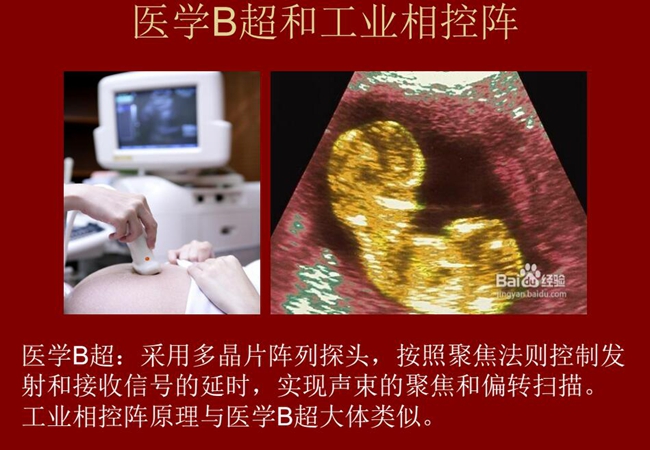 工業(yè)相控陣原理與醫(yī)學(xué)B超大體類似，醫(yī)學(xué)B超采用多晶片陣列探頭，按照聚焦法則控制發(fā)射和接收信號(hào)的延時(shí)，實(shí)現(xiàn)聲束的聚焦和偏轉(zhuǎn)掃描